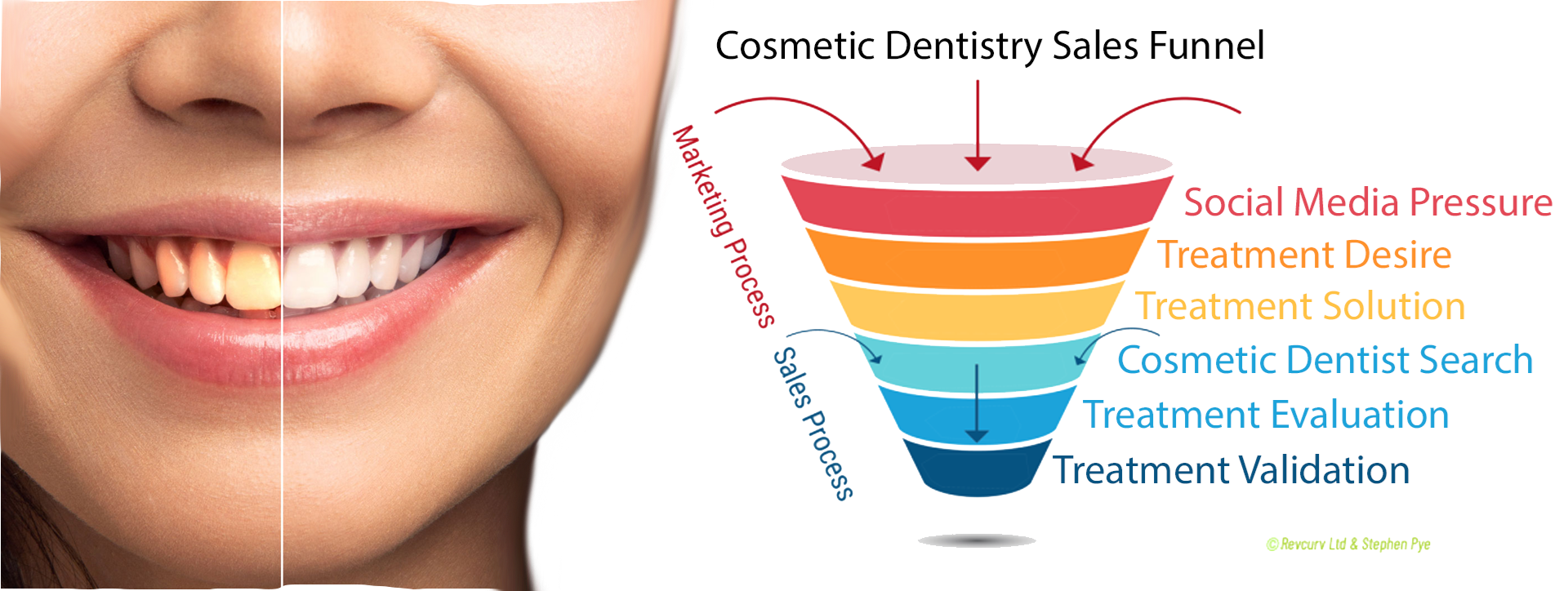 Dental Treatment Funnel SmylorDental Treatment Marketplaces